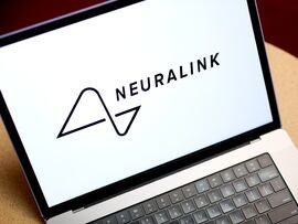 用你的思想下棋 - Neuralink 发布大脑植入受试者的视频（彭博社） - 雅虎新闻